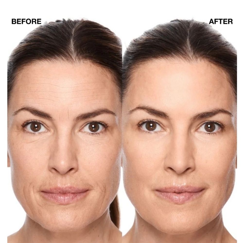 Liquid Facelift Wand - Silver & White - Picture 3 of 5
